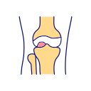 Joint Replacement Surgery Rehab Link